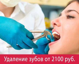 Болит зуб? Причины, симптомы и лечение зубной боли
