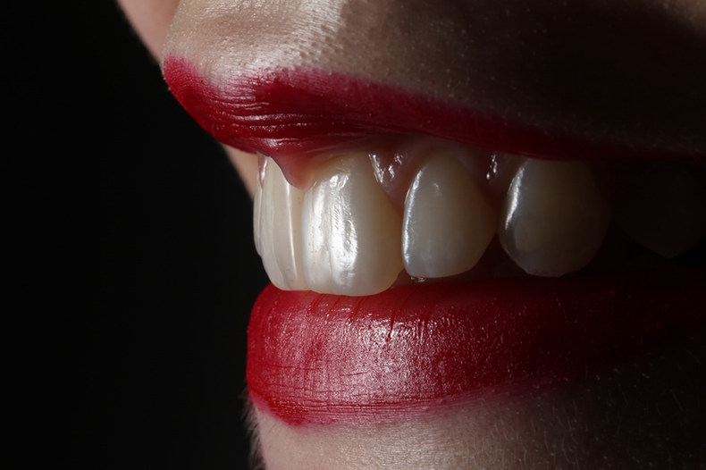 Гигиена — ключевой способ профилактики образования зубного налета, фото