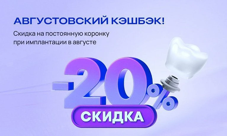 Августовский кэшбэк: скидка 20% на коронку