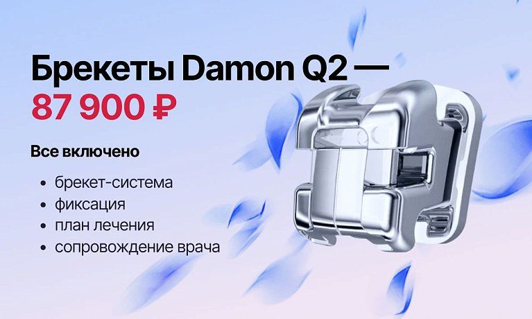 Специальная цена на брекеты Damon Q2 — 87 900 ₽