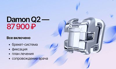 Специальная цена на брекеты Damon Q2 — 87 900 ₽