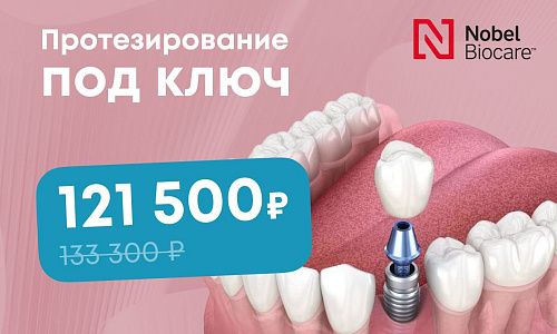 Протезирование под ключ: имплант Nobel + металлокерамическая коронка