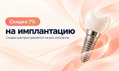Скидка 7% на имплантацию