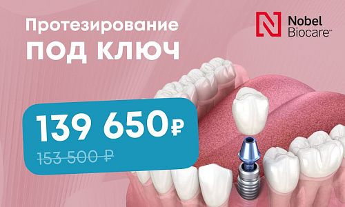 Протезирование под ключ: имплант Nobel + металлокерамическая коронка