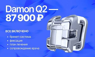 Специальная цена на брекеты Damon Q2 — 87 900 ₽