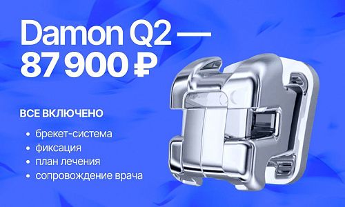 Специальная цена на брекеты Damon Q2 — 87 900 ₽