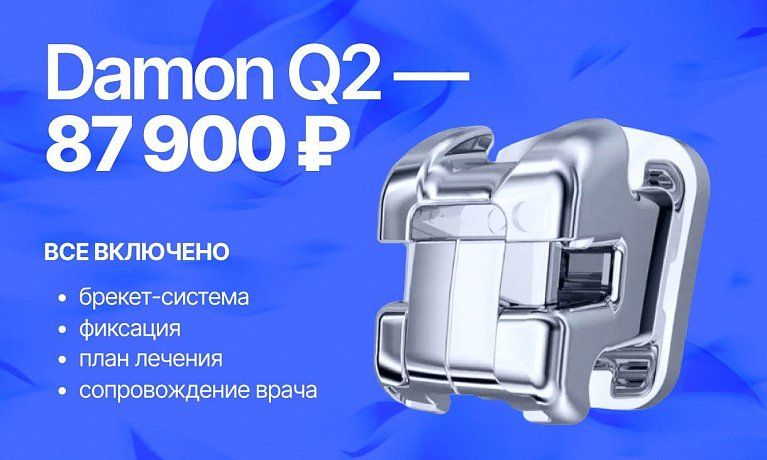 Специальная цена на брекеты Damon Q2 — 87 900 ₽