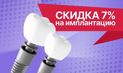 Скидка 7% на имплантацию