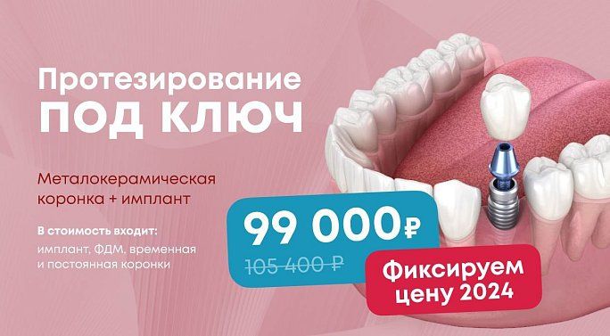 Протезирование под ключ: имплант HI-TEC + металлокерамическая коронка