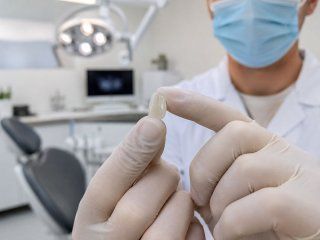 Виниры – что это, преимущества и показания