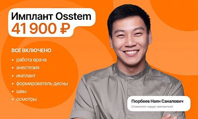Имплант Osstem без доплат — 41 900 ₽
