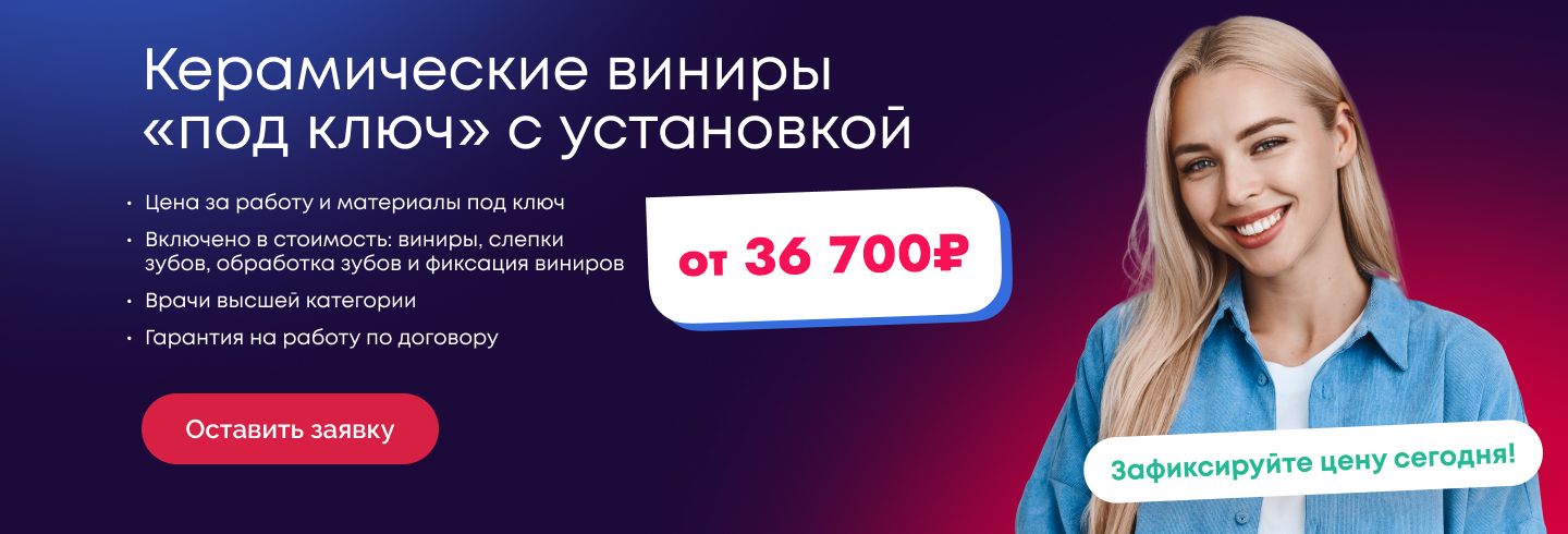 Виниры на зубы