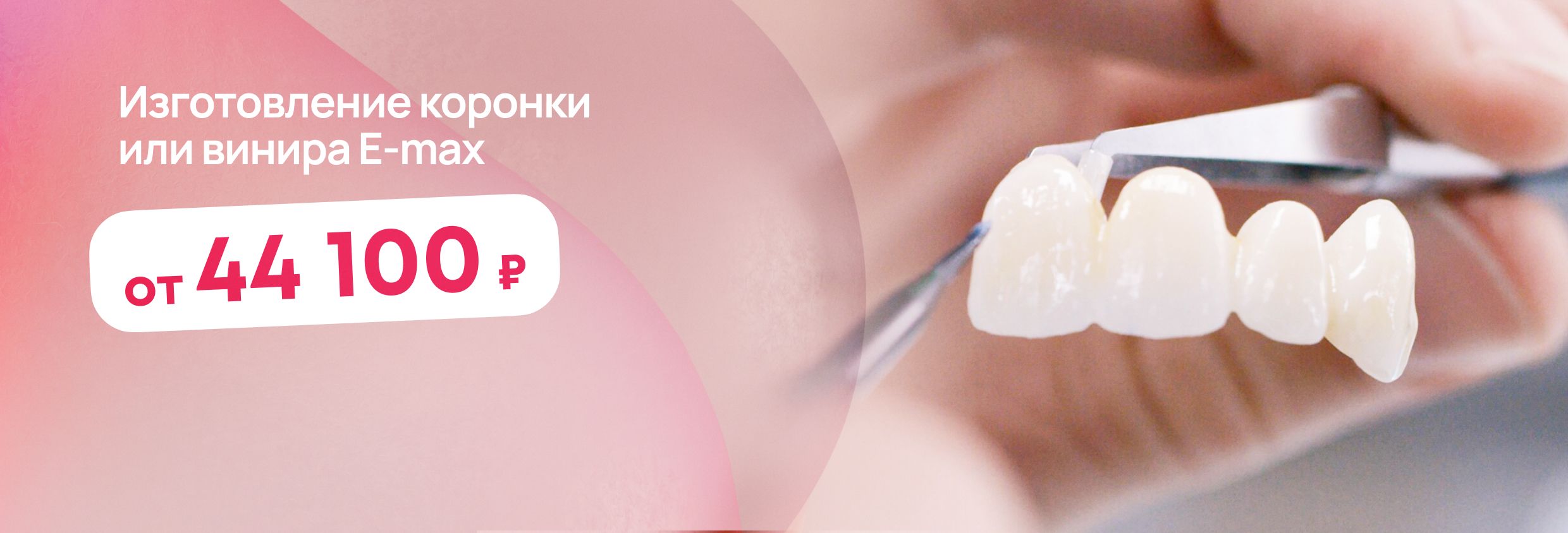 Керамические виниры